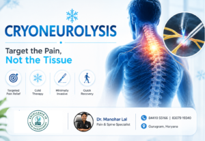 Cryoneurolysis